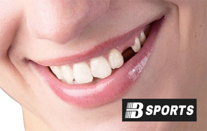 Nằm mơ rụng răng đánh con gì dễ trúng nhất ở Bsports