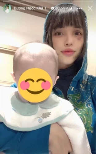 Gương mặt bầm tím của Siêu mẫu khi bên cạnh cậu con trai cưng