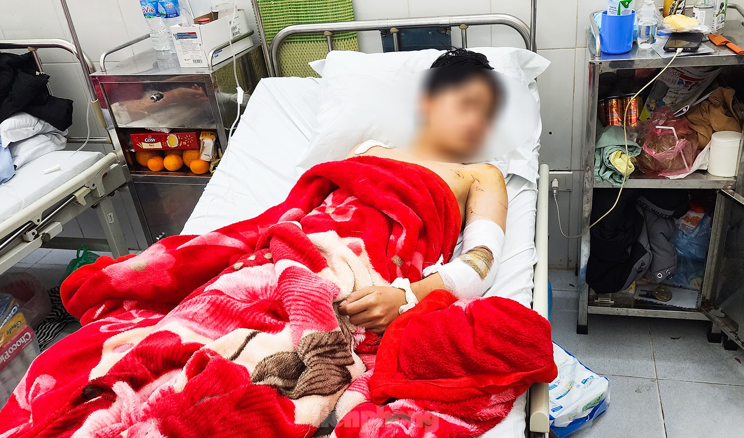 Nam sinh V. trong quá trình điều trị trấn thương
